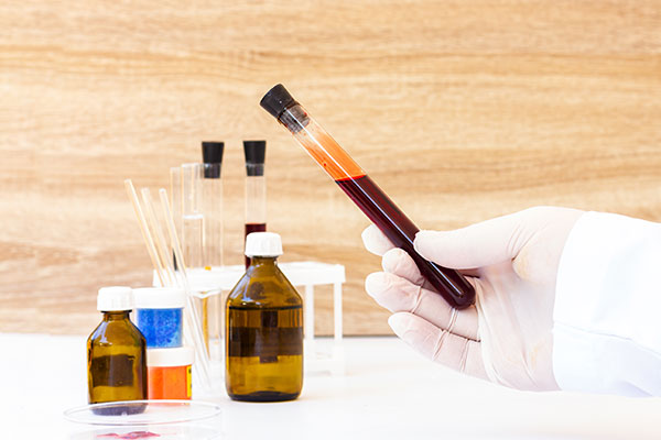 Imagen de Curso en Análisis Instrumental Básico en Toxicología y Bioquímica