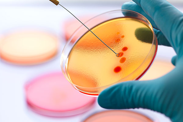 Imagen de Curso de Desarrollo Profesional en Manejo Práctico de Infecciones y Uso Racional de Antimicrobianos