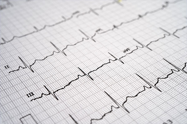Imagen de Curso en Actualización en Electrocardiografía Clínica y Arritmias