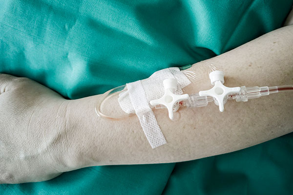 Imagen de Curso en Cuidados de Enfermería en el Acceso Vascular y Terapia Intravenosa