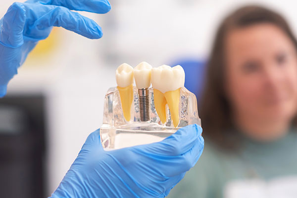 Imagen de Curso de Desarrollo Profesional  en Mantenimiento y Cuidado de Implantes Dentales para Higienistas