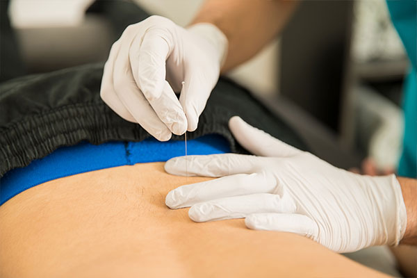 Imagen de Curso en Fisioterapia Invasiva: Punción Seca y Neuromodulación
